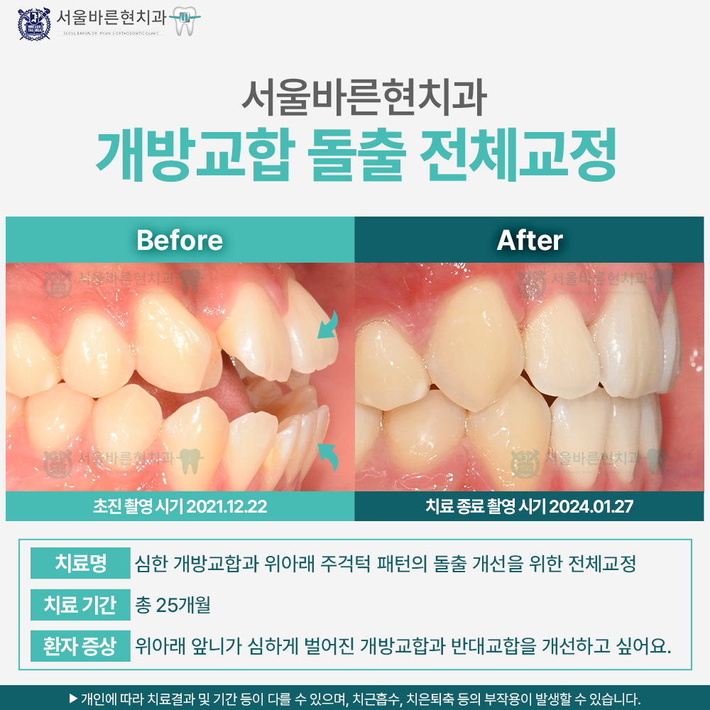 부산교정치과