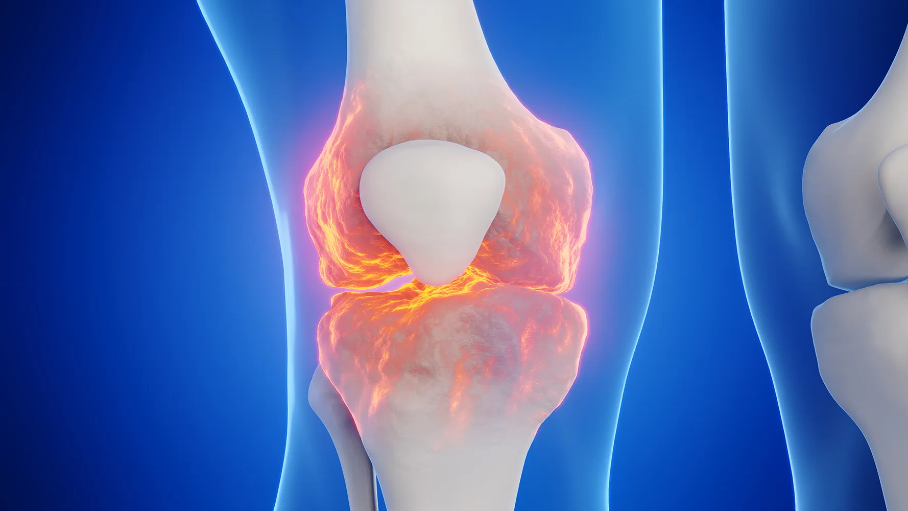 남성의 무릎을 3D 렌더링한 의료 일러스트레이션