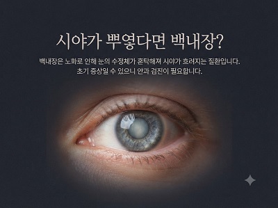 시야가 뿌연 백내장증상