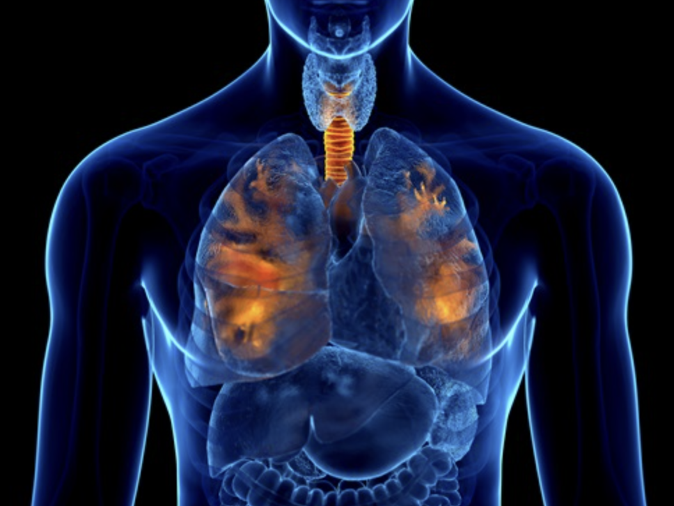 감기 독감 폐렴 관련 이미지