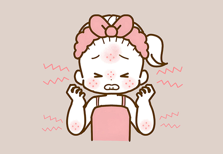 알레르기가-생긴-여성