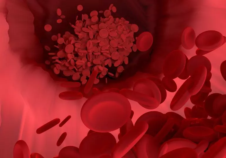 혈액 순환 개선 (Improved Blood Circulation)