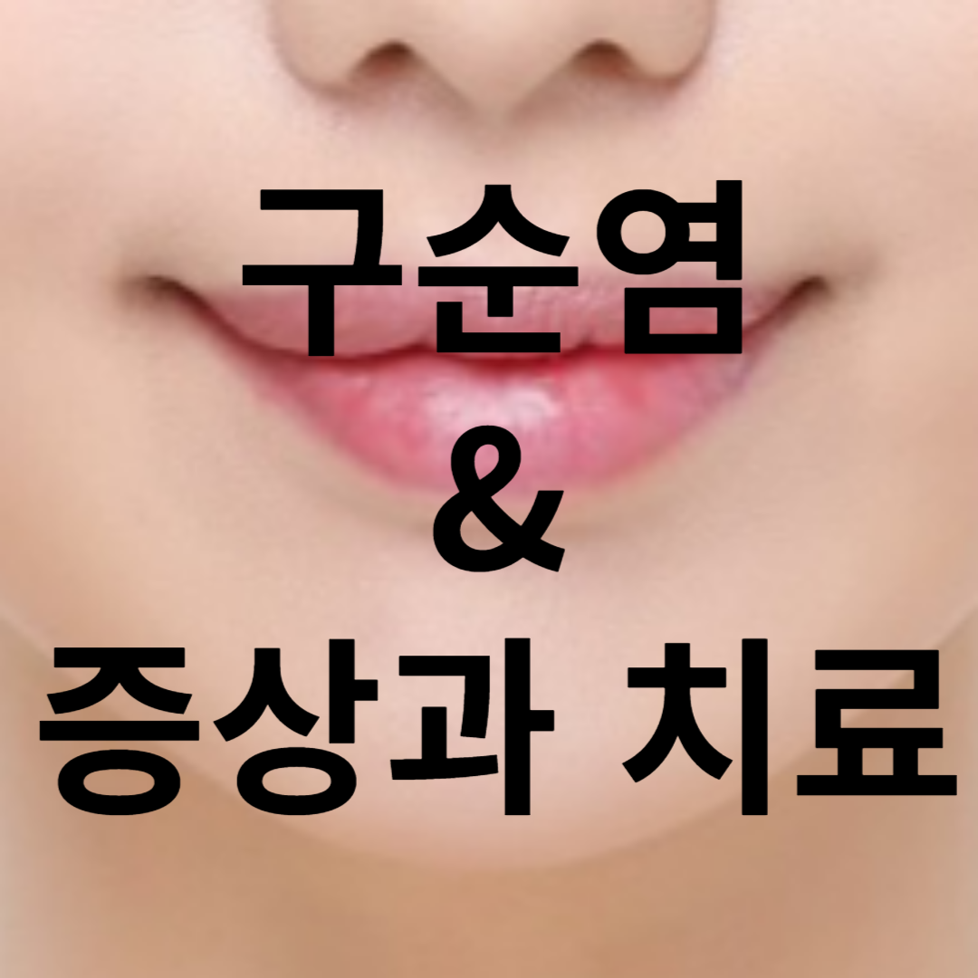 구순염 증상과 치료