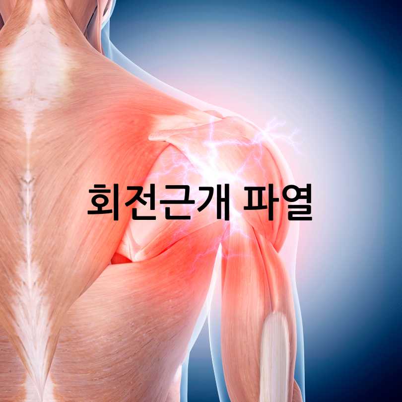 어깨 통증 원인