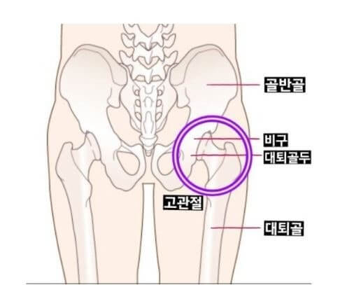 고관절 통증 7일 완화 루틴