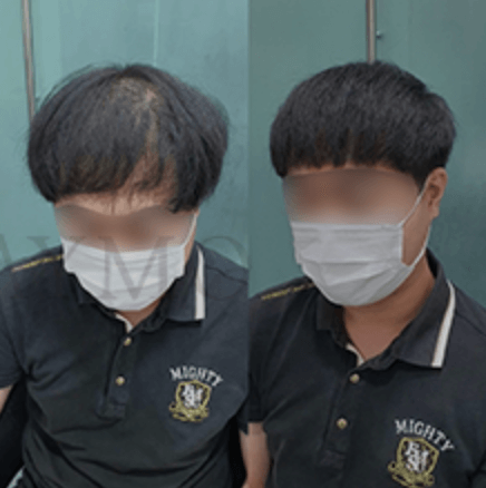 가발의여왕(메이모)