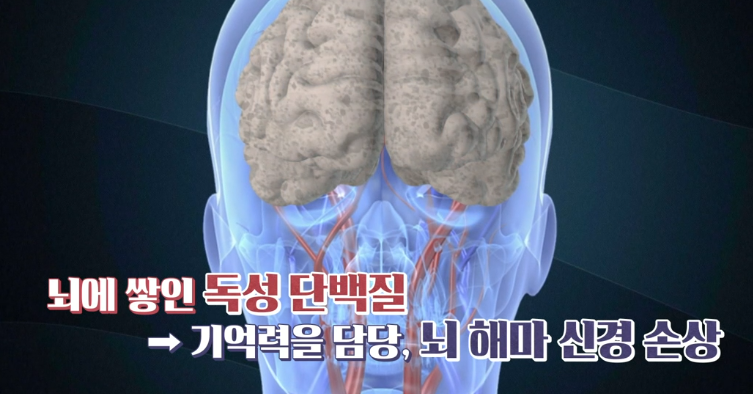 포스파티딜세린 효능