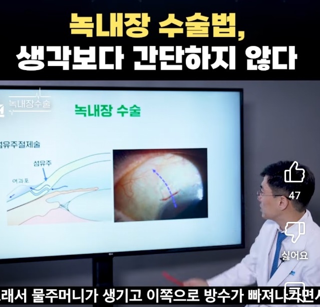 EBS-명의-녹내장-명의-박찬기-교수