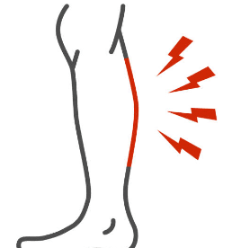 하지 정맥류 증상 수술비용