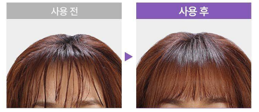 아쿠아 캡슐 트리트먼트 뿌리볼륨 고민 올영 추천템