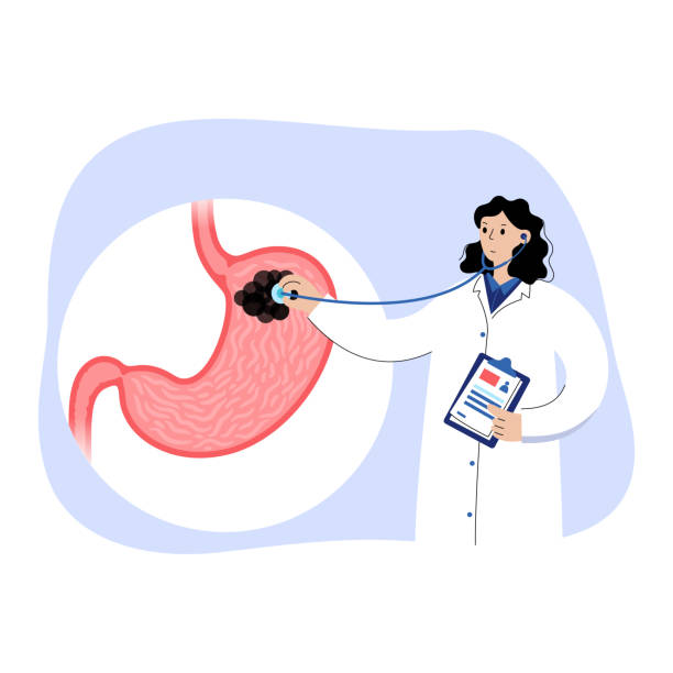 위산 과다 vs 위산 부족: 맞춤형 위장약 선택