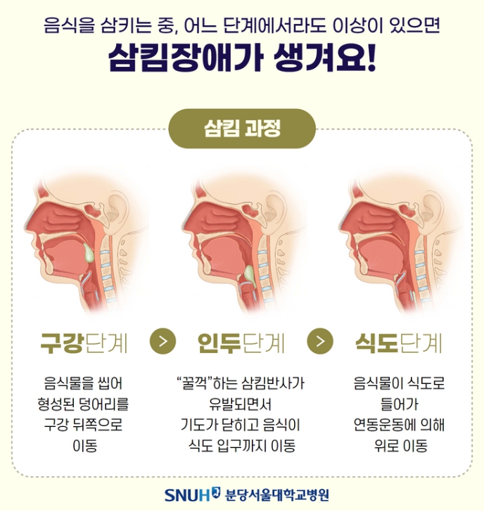 식도염 이미지