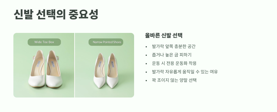 발톱이 살을 파고들때 해결법 5