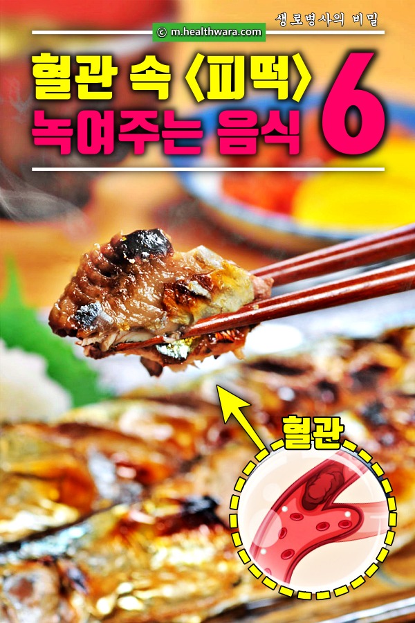 혈전에 좋은 음식,혈전 녹이는 음식,팁줌