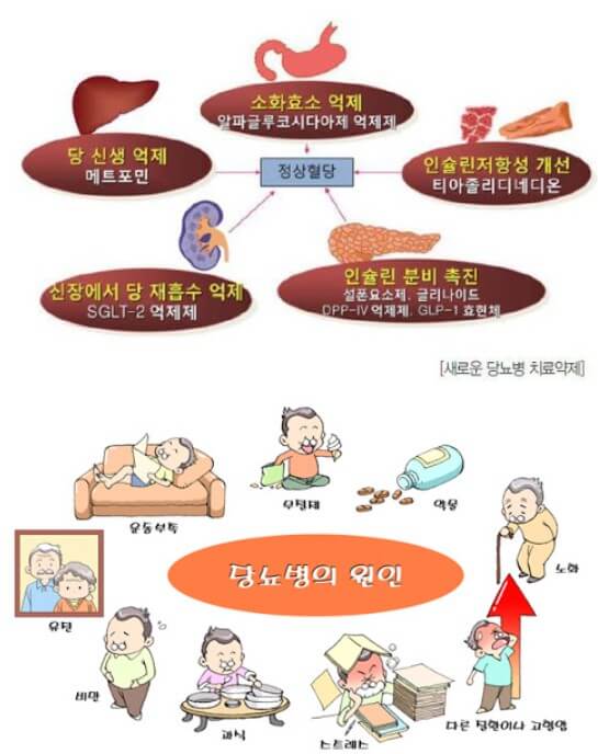 당뇨병의 원인을 설명