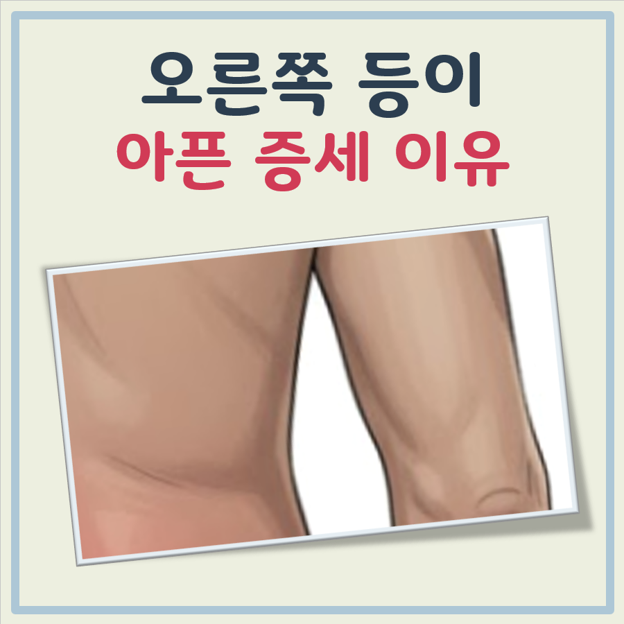 오른쪽 등이 아픈 증세 대표 이미지
