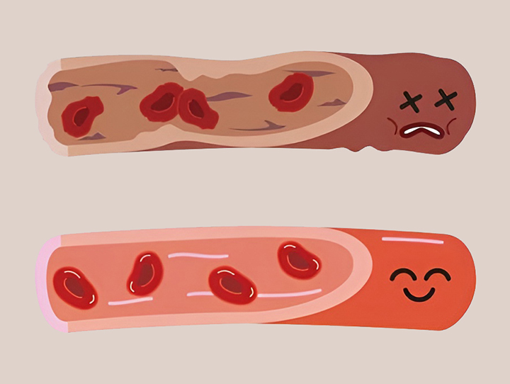 심혈관-건강-증진