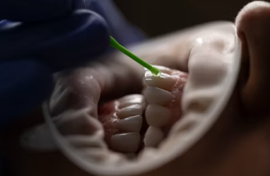 라이나생명 치아보험 청구서류 해지 보장내용