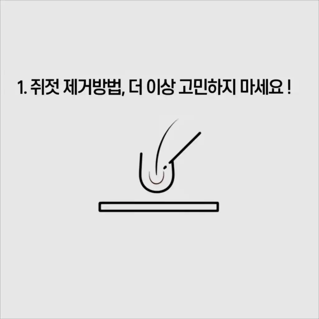 쥐젖 제거방법을 시각적으로 제시. 쥐젖 고민을 끝낼 다양한 시술법을 설명합니다.