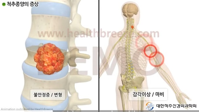 김치헌교수