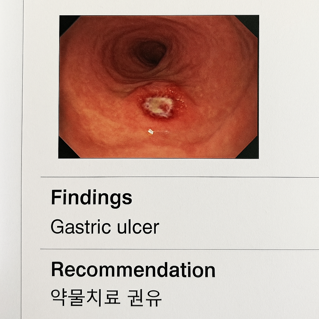 국가건강검진