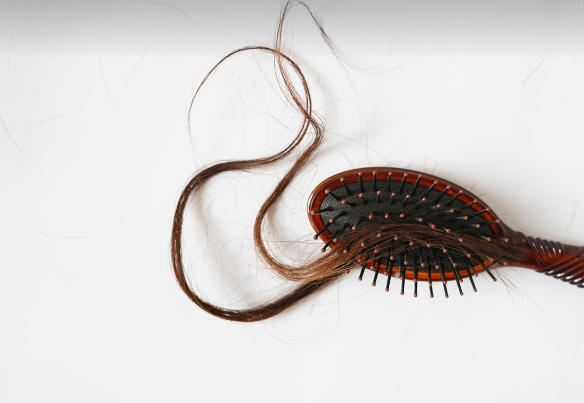 갱년기 탈모 증상