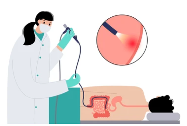 대장내시경 검사