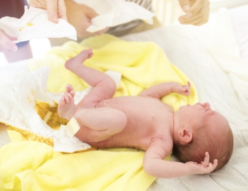 신생아 변 색깔로 보는 건강 상태