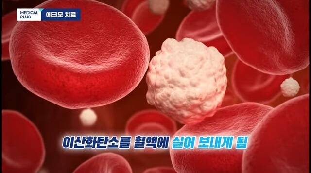 체외순환사-하는일-연봉-자격조건확인하기