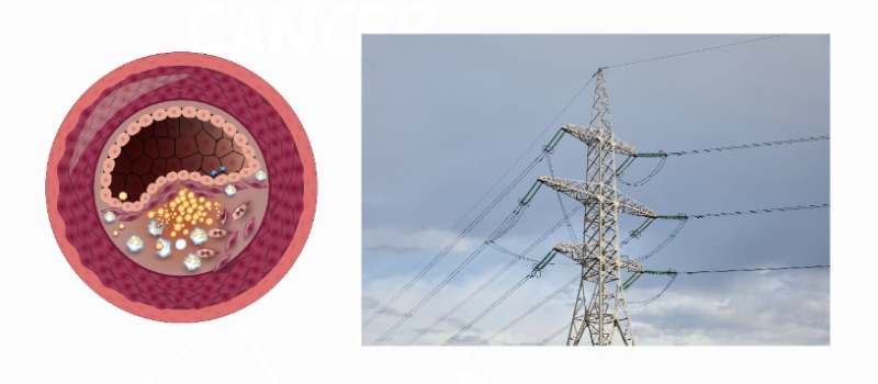 정전기없애는법 혈관 전기