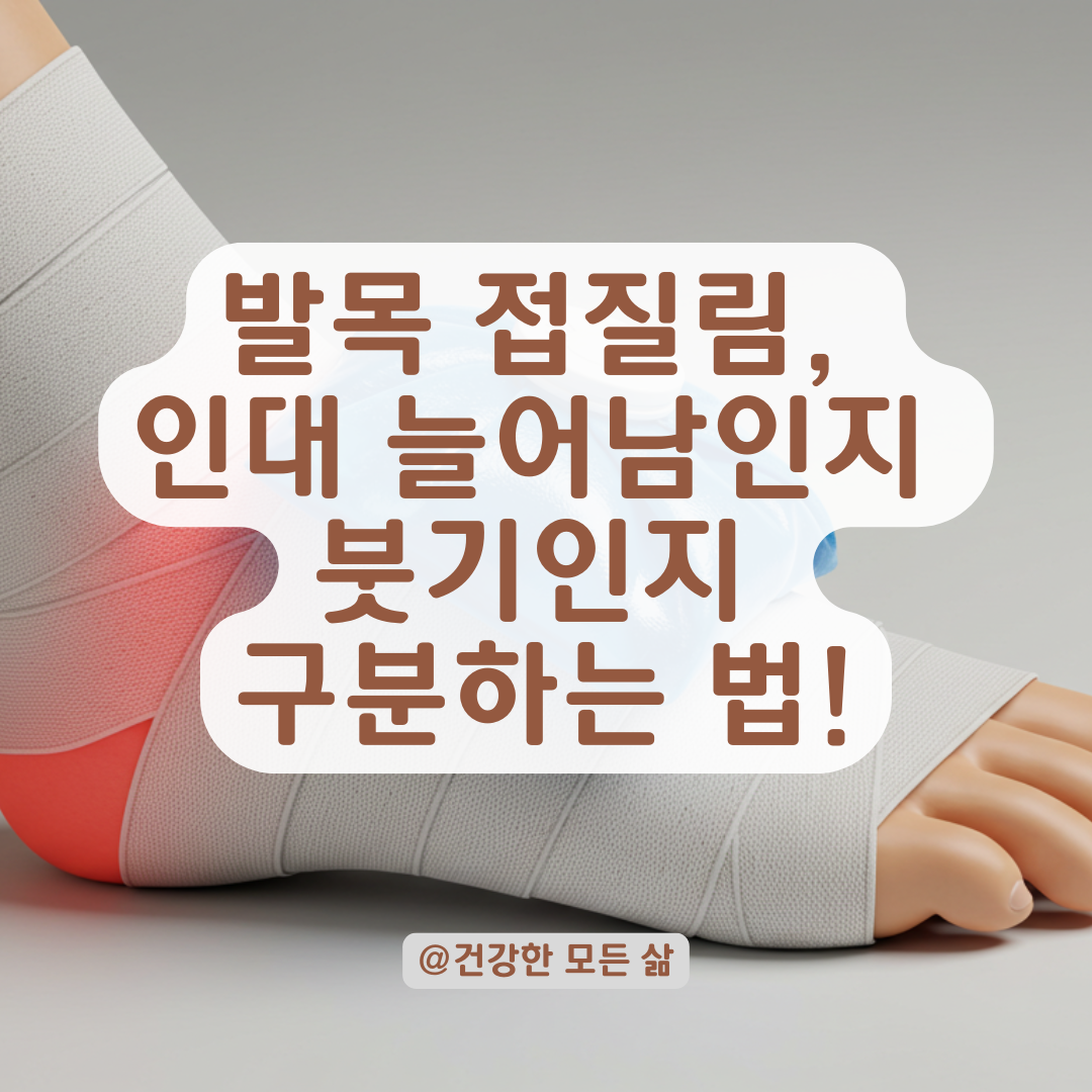 인대 늘어남과 단순 붓기 구분하는 법, 발목 접질렸을 때 체크포인트.