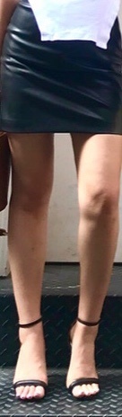 허벅지 지방흡입 후기