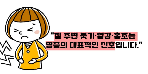 질염 증상 원인