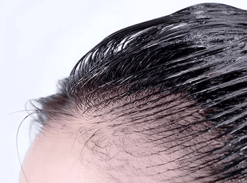 머리에 염색샴푸를 발랐을 때의 확대 사진