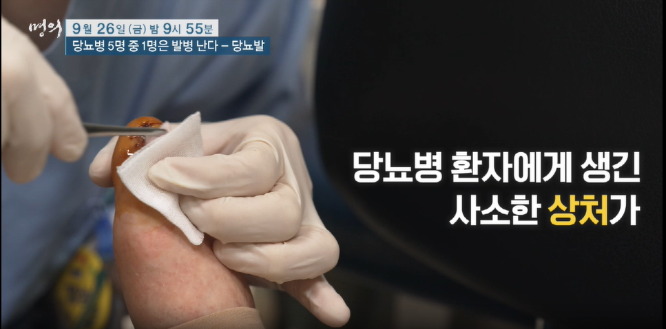 ebs명의 - 당뇨병 5명 중 1명은 발병 난다 / 당뇨발