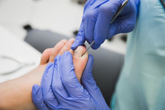 내성 발톱 절제술 (부분 발톱 제거술, Partial Nail Avulsion) &ndash; 수술 방법 &amp; 회복 과정