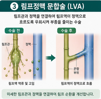 치료법