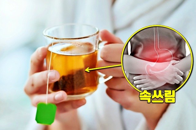 속쓰림 증상 원인 음식, 녹차 홍차, 식도염, 위식도역류, 건강, 매일꿀정보