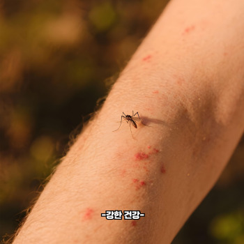 스키터 증후군 증상