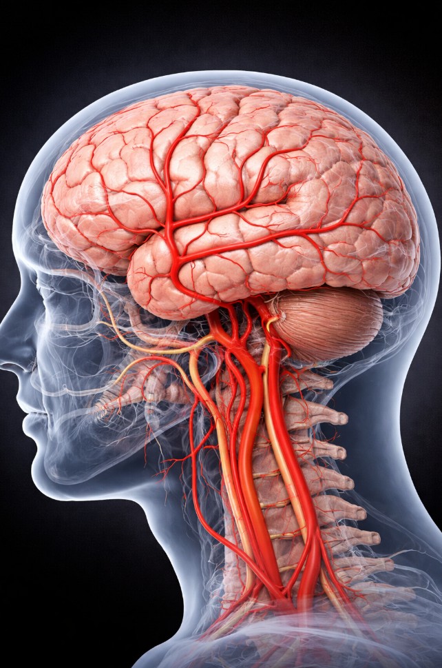 뇌졸중 예방 뇌와 혈관구조