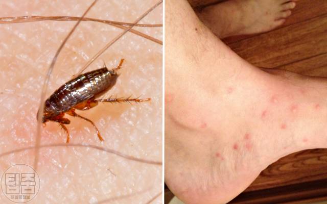 벼룩 물린자국 확인,건강