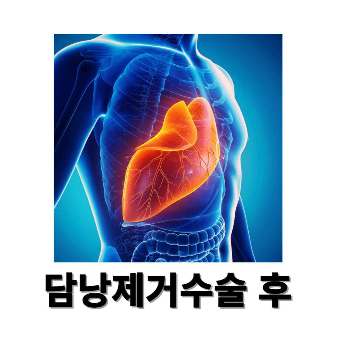 담낭제거수술과 관련된 사진입니다.