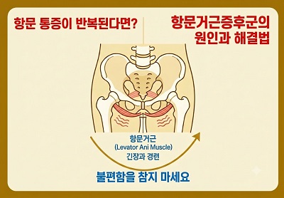 항문거근증후군