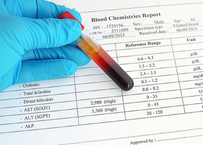 아밀라제 수치가 높은 이유