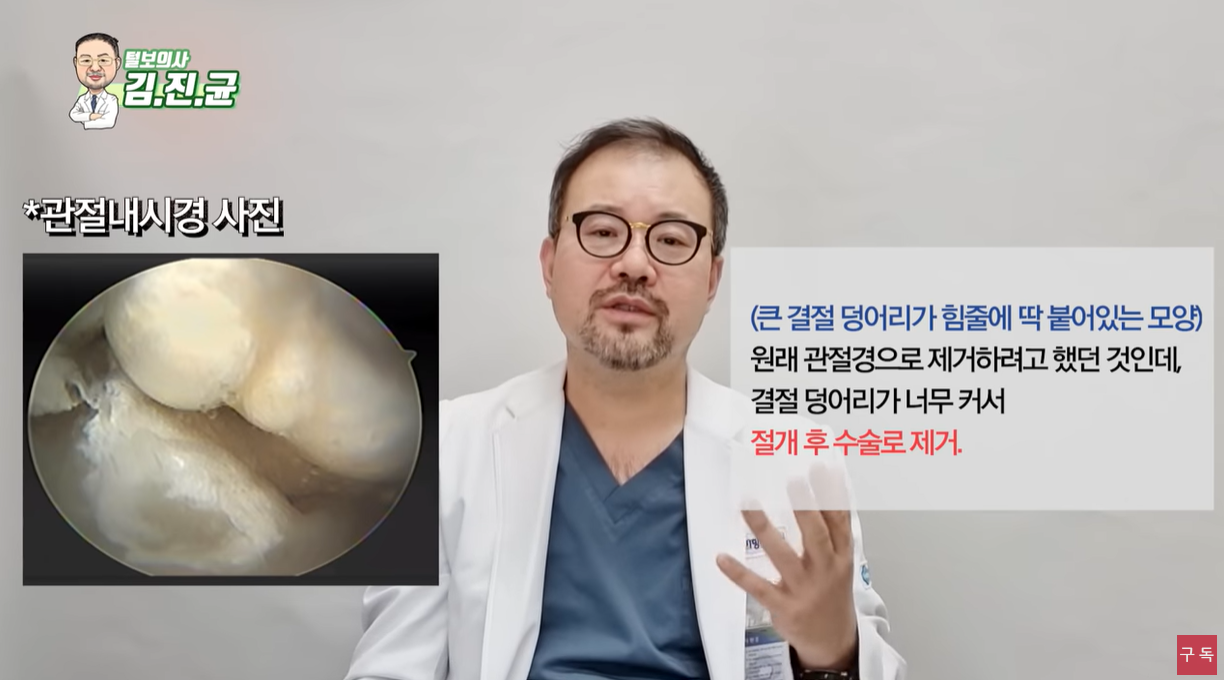 통풍결절 제거