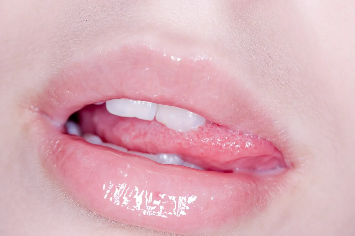 혓바늘이 돋는 이유