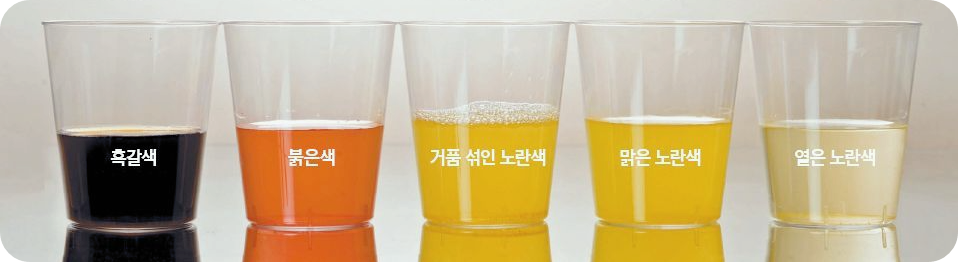 간수치가-높으면-나타나는-증상