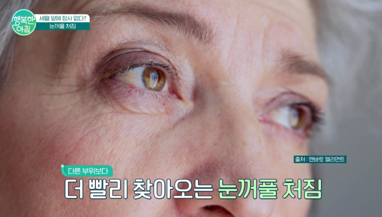 신사리프팅성형외과 눈밑지방재배치수술비용