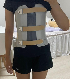 척추측만증-보조기-착용-모습