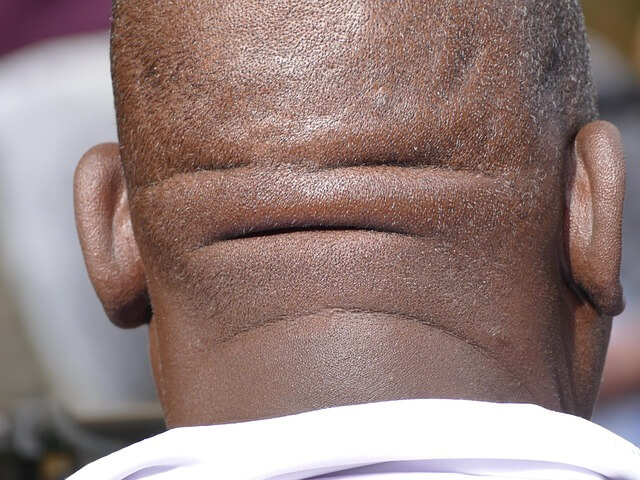 거북목 예방 교정 가이드-집에서 하는 셀프교정법